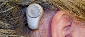 bone anchored hearing aid img